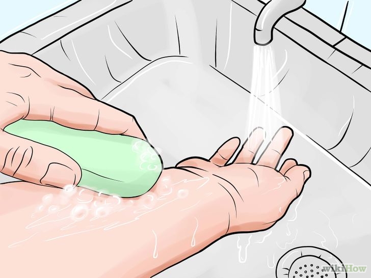 Рану можно мыть. Попадание биологических жидкостей на кожные покровы. Промывание раны антисептиком. Промыть рану водой с мылом.